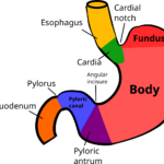 Understanding Pyloric Stenosis: Diagnosis and Management